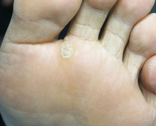 48세 남성 · 20개월 경과 · 치료 전