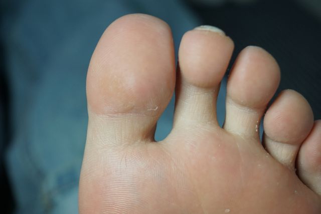 33세 여성 · 2년 경과