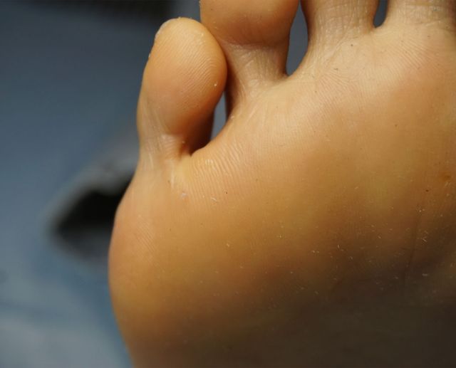 41세 여성 · 6개월 경과