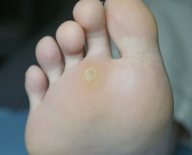 10세 여성 · 9개월 경과 · 치료 전